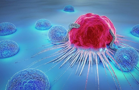 Ăn thường xuyên những loại thực phẩm này, bạn dễ bị ung thư